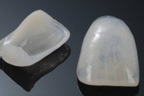 carillas-dentales-de-porcelana