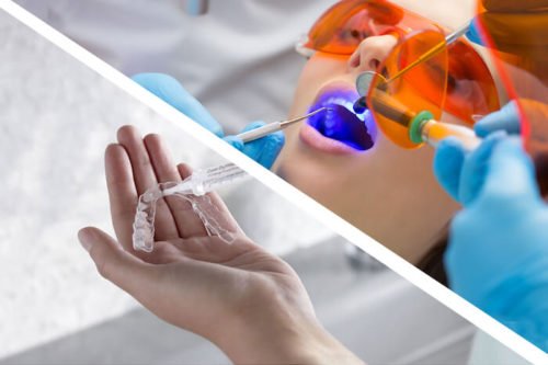 blanqueamiento-dental-combinado-en-barcelona