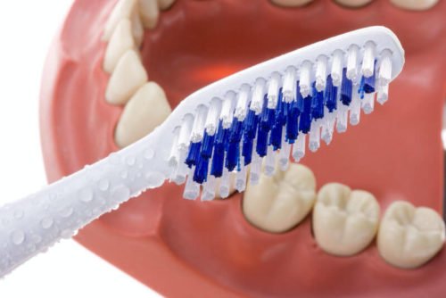 cuidados-de-las-prótesis-dentales-clínica-dental-vas-en-barcelona