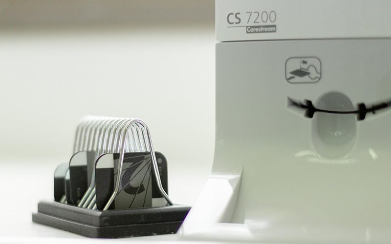 odontologia-conservadora-clinica-dental-vas