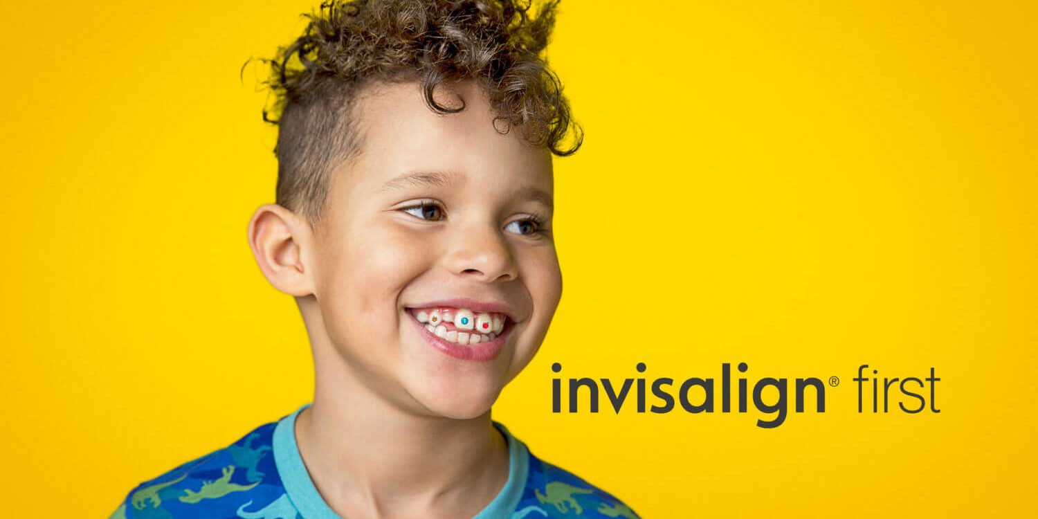 invisalign-para-niños-barcelona