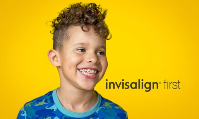 invisalign-para-niños-barcelona